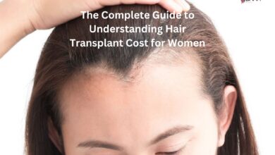Photo of The Complete Guide to Understanding Hair Transplant Cost for Women