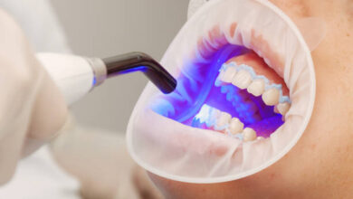 Photo of Whiten Your Way: Personalized Teeth Whitening Solutions in Riyadh